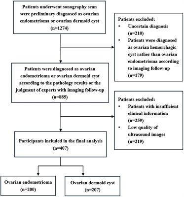 Ultrasound radiomics-based artificial intelligence model to assist in the differential diagnosis of ovarian endometrioma and ovarian dermoid cyst